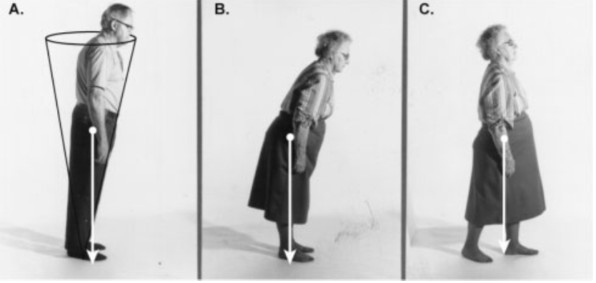 姿勢制御の運動戦略（足関節戦略・股関節戦略・ステッピング戦略）のイラスト