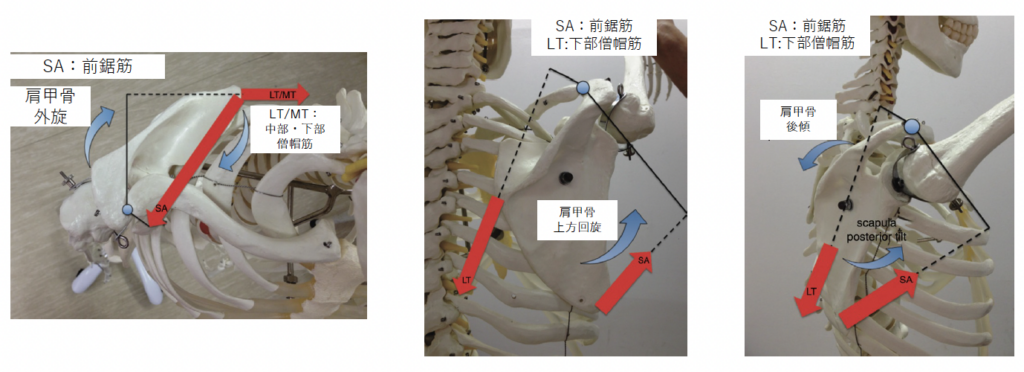 肩甲骨の後傾運動に関与する下部僧帽筋のベクトル図