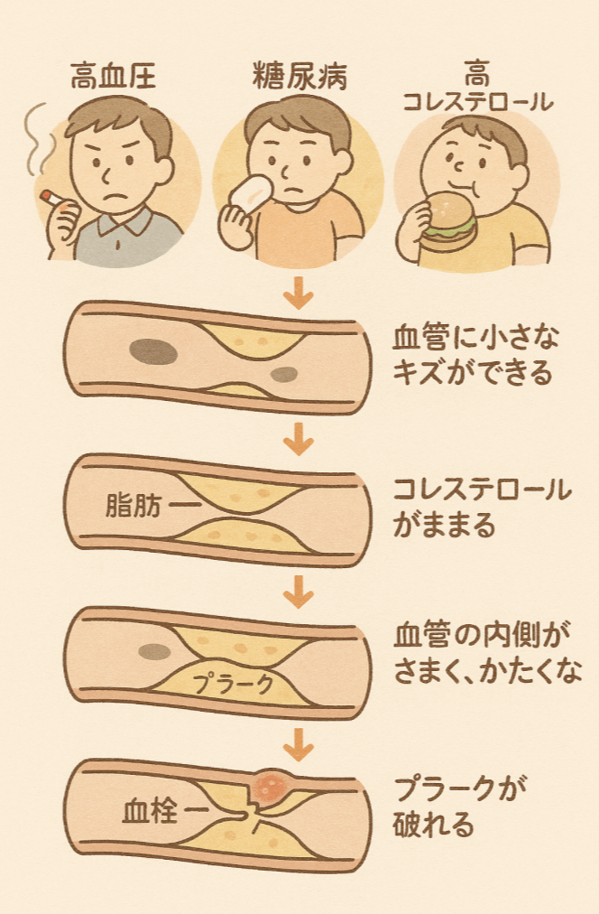 生活習慣病によって生じる血管へのダメージ
