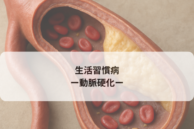 生活習慣病　−動脈硬化について−